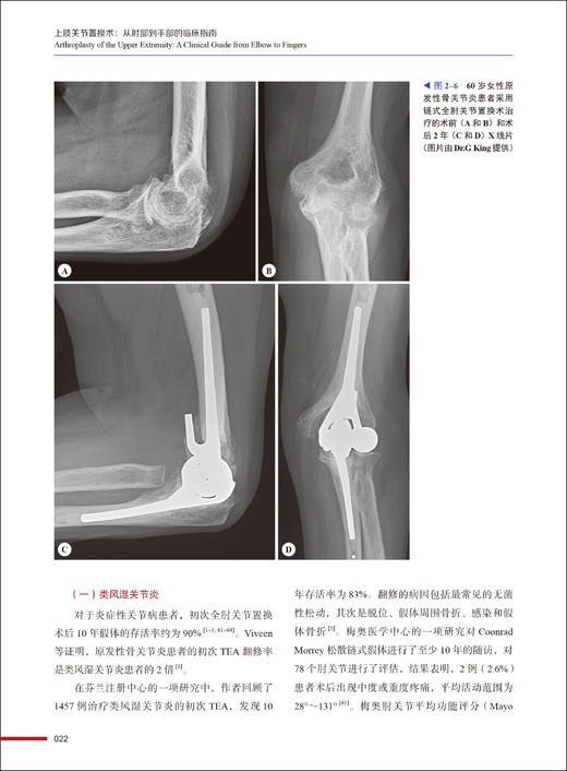 上肢关节置换术 从肘部到手部的临床指南 徐永清 崔轶主译 关节置换适应证技术 植入物基本原理 中国科学技术出版社9787523606070 商品图3