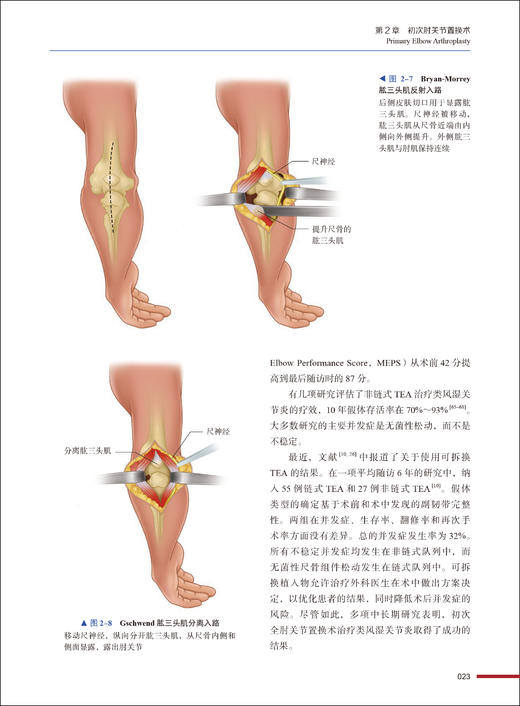 上肢关节置换术 从肘部到手部的临床指南 徐永清 崔轶主译 关节置换适应证技术 植入物基本原理 中国科学技术出版社9787523606070 商品图4