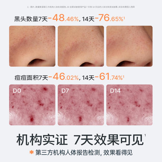 海龟爸爸双萃控油祛痘洁面乳 商品图4