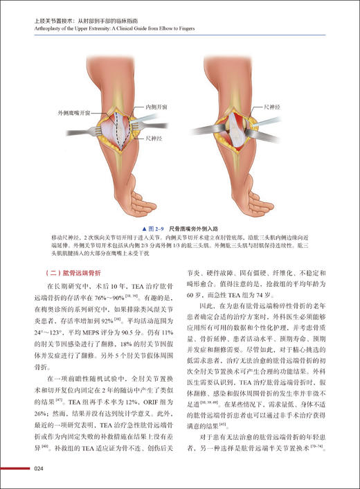 上肢关节置换术 从肘部到手部的临床指南 徐永清 崔轶主译 关节置换适应证技术 植入物基本原理 中国科学技术出版社9787523606070 商品图2