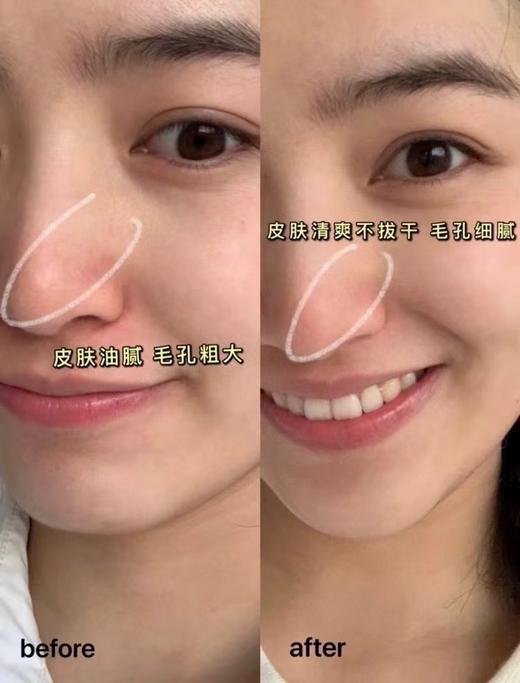 Y诗红石榴不限年龄滋养型洁面清洁面膜两用洗面奶 商品图12