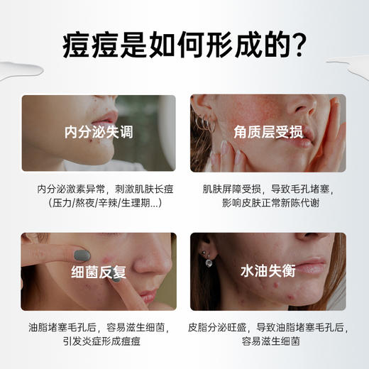 【营养师专属G】法国碧维斯Biocyte控油祛痘胶囊淡痘印 内服调理修复养生D 商品图1