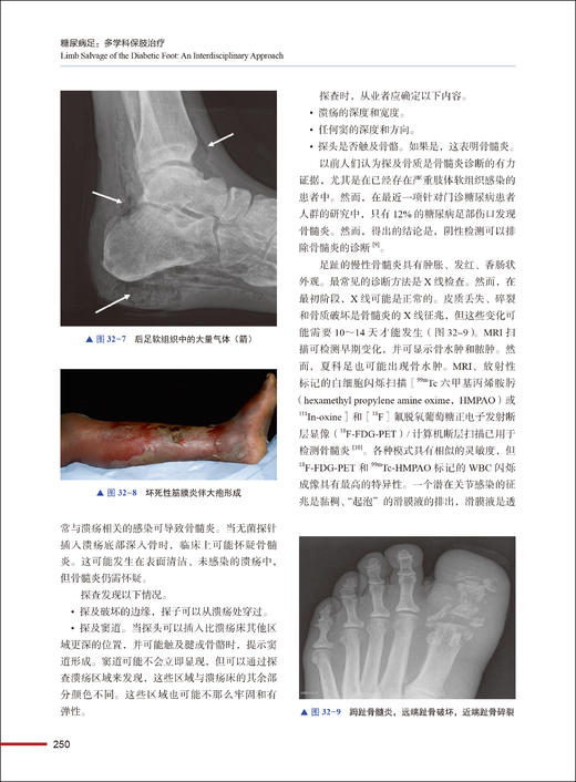 糖尿病足 多学科保肢治疗 赵宏谋 鹿亮 张明珠主译 糖尿病足分类诊断临床评估规范化保肢治疗策略9787523604854中国科学技术出版社 商品图4