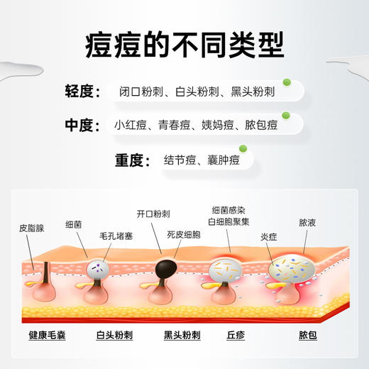 【营养师专属G】法国碧维斯Biocyte控油祛痘胶囊淡痘印 内服调理修复养生D 商品图4