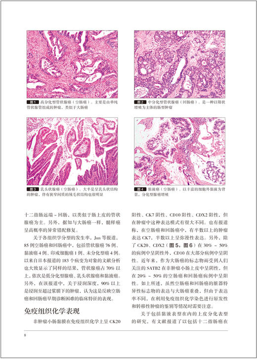 胃与肠 原发性小肠癌的全貌观察 日本胃与肠编委会编著 辽宁科学技术出版社9787559135902 商品图3