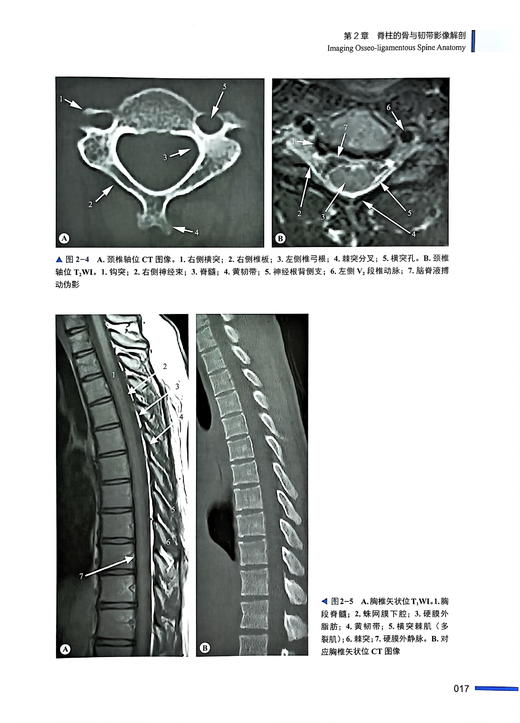 影像引导脊柱微创介入技术 孙钢等译 脊柱介入诊疗基础知识 各类介入技术操作方法技巧及临床实践9787523604861中国科学技术出版社 商品图4