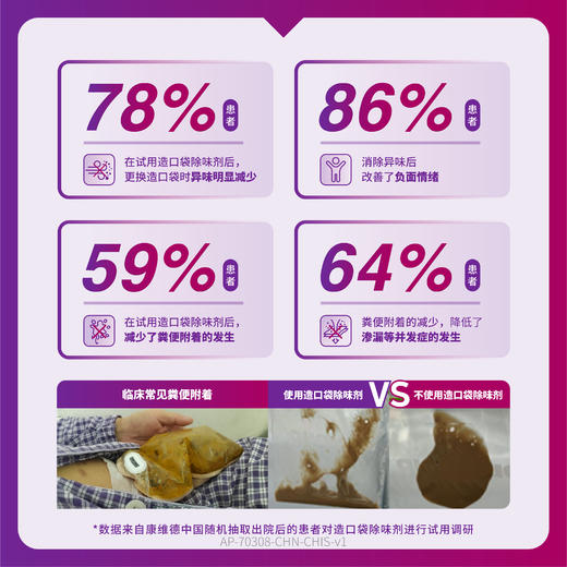 康维德造口袋除味剂OCL润滑除味236ML大瓶装423574 商品图1