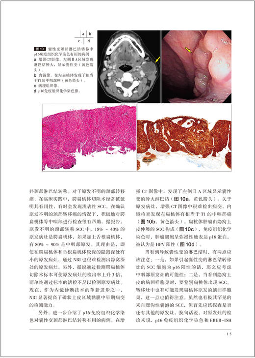 胃与肠 咽部浅表癌的内镜诊断与治疗 咽疾病癌内窥镜诊疗（日）《胃与肠》编委会编著  辽宁科学技术出版社 9787559134868 商品图3