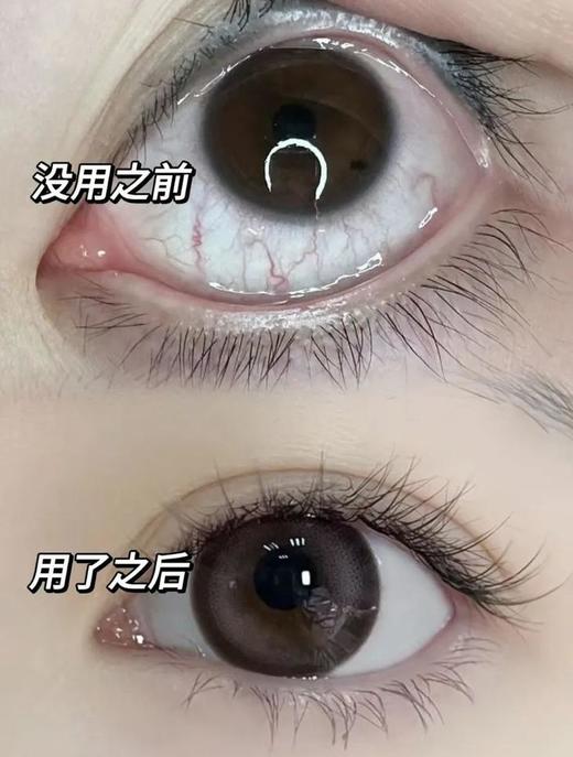 澳洲🇦🇺原装进口 【奈力士·‬蓝莓叶黄素酯护眼片】✔️缓解眼部疲劳✔️抵御蓝光✔️补充眼部营养（48小时内发货） 商品图4