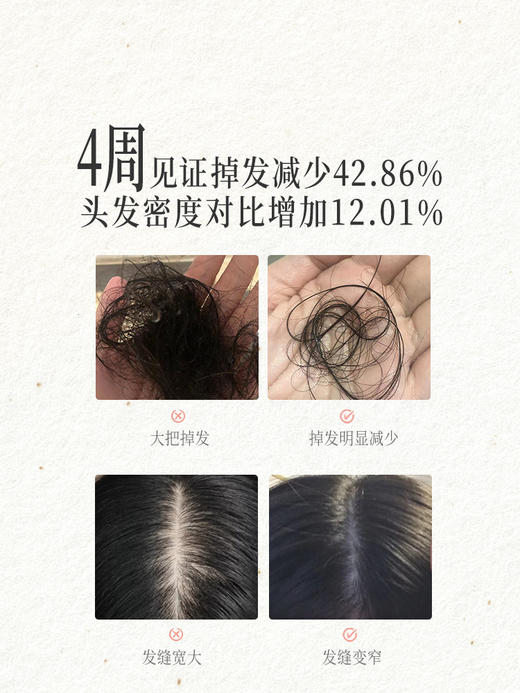 【控油 防脱】中药植物草本洗发水 控油蓬松 沙发防脱 侧伯叶 （买就送4袋试用装小样） 商品图6