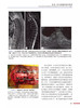 脊柱肿瘤外科学 现代多学科策略 高延征 廖文胜 主译 经典骨科学译著 可作为住院医师和入门脊柱外科医师指导书 9787523606186 商品缩略图4