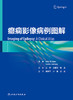 癫痫影像病例图解 2024年7月参考书 商品缩略图1