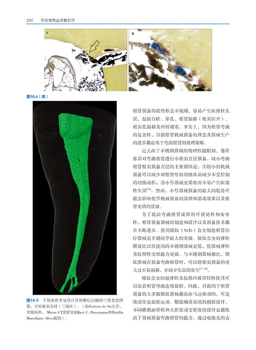 恒牙根管应用解剖学 巴西 马可 韦尔西阿尼 著 游月华 杨亚萍 杨焰 主译 口腔科医生 辽宁科学技术出版社9787559132581 商品图3