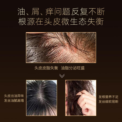 温莎森林根源强韧精华洗发露|姜根焕活精华，护根防断发 商品图3