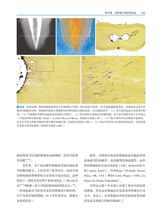 恒牙根管应用解剖学 巴西 马可 韦尔西阿尼 著 游月华 杨亚萍 杨焰 主译 口腔科医生 辽宁科学技术出版社9787559132581 商品图4