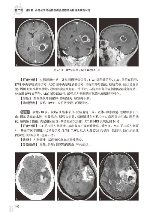 颅脑疾病多模态磁共振成像诊断思路及案例解析 曹代荣 李坚 邢振 常见颅脑疾病多模态磁共振成像典型病例分析 9787117360777 商品图3