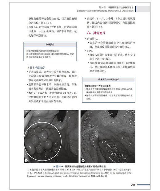 介入放射学应知应会 杜鹏 周瑞臣 孙立伟主译 放射学原理 影像引导方式 介入治疗方法技术技巧 中国科学技术出版社9787523607503 商品图3