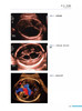 产科超声 基于胎儿异常的诊断思路 原书第2版 吴青青 等译 适合母胎医学 产科学 超声医学专业医生及医学生参考阅读 9787523606285 商品缩略图4