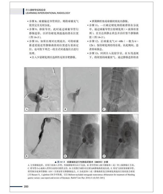 介入放射学应知应会 杜鹏 周瑞臣 孙立伟主译 放射学原理 影像引导方式 介入治疗方法技术技巧 中国科学技术出版社9787523607503 商品图4