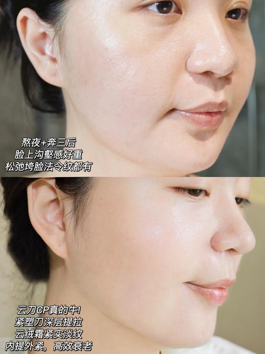 【7.27王炸割肉价】新品LAMER海蓝之谜紧塑刀精华3ml*2 商品图5