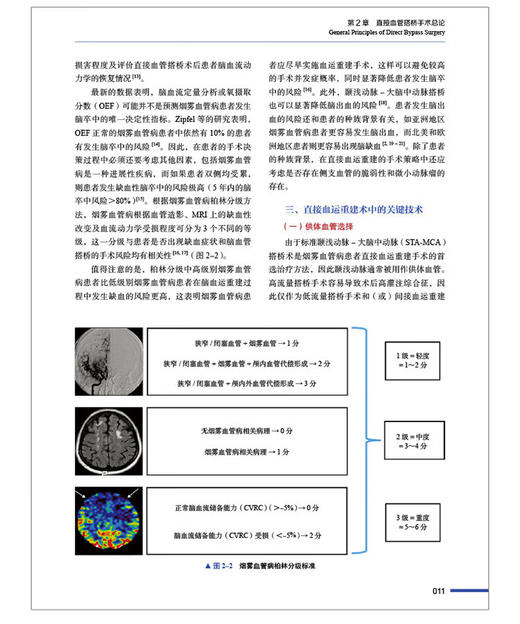 烟雾血管病手术技巧 陈劲草 章剑剑 主译 烟雾血管病手术方法要领技巧实用指南 典型病例分析 中国科学技术出版社9787523606124 商品图4