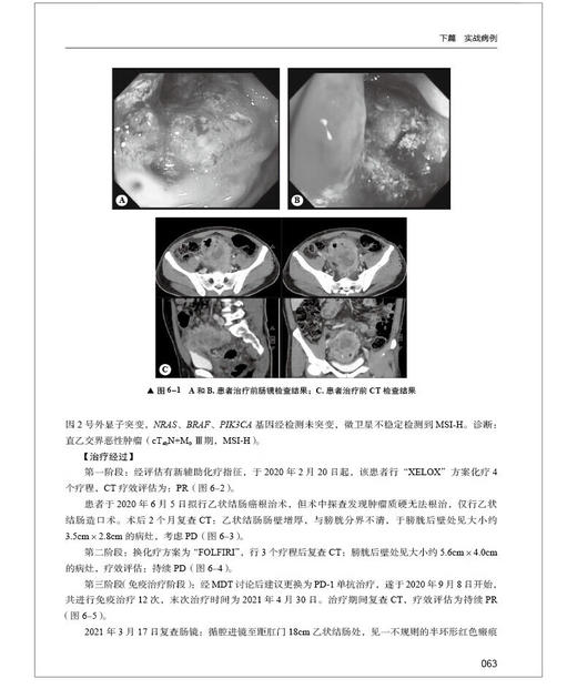 结直肠癌免疫治疗学 临床诊疗思维 丁培荣 结直肠癌临床诊治经典案例 免疫治疗不良反应处理指导 中国科学技术出版社9787523606308 商品图3