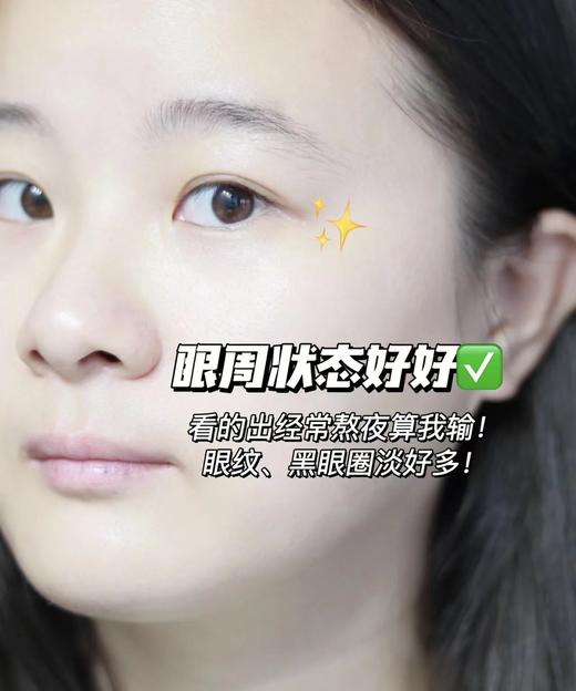 欧L雅二代升级紫熨斗眼霜颈纹法令纹熨斗 商品图11