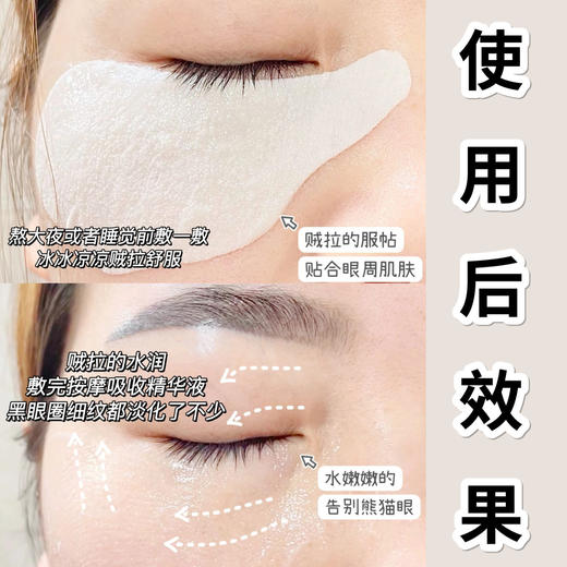 特价清👉🏻89💰14对⁠【新西兰🇳🇿Coco虾青素眼膜】主打虾青素抗氧➕DNA修复酶🐼丨对老化眼纹/黑眼圈/眼袋非常奏效 ⁡成分安全无添加❗⁥ 孕妇/敏肌可用🏆品牌直发 商品图3