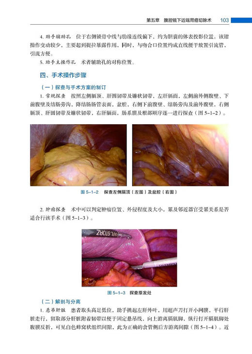 腹腔镜胃肠肿瘤手术学 配视频 程向东主编 手术基本操作技术 前期处理术后护理 临床医生实践指导书 清华大学出版社9787302656401 商品图4