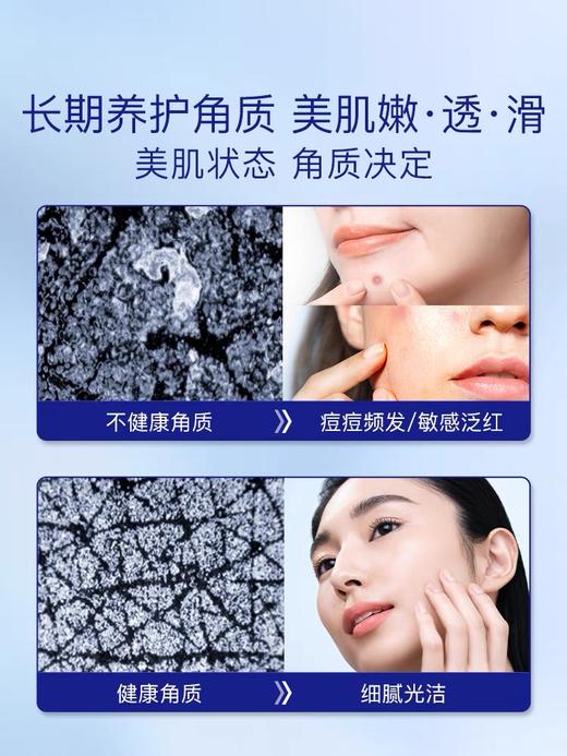 嫩成豆腐！takami小蓝瓶肌底精华液30ml角质养护 粉刺闭口收毛孔 商品图2