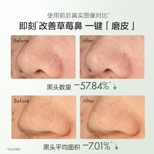 【高效去黑头】欧诗漫平衡净透去黑头鼻贴膜5片*2盒 商品图2