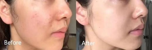 真爱面霜系列NO.1  SK2大红瓶面霜15g 商品图4