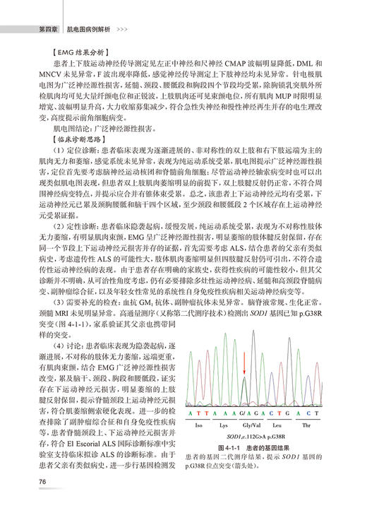 北京协和医院肌电图临床应用病例解析 崔丽英 肌电图领域神经肌肉病病例分析总结诊断应用 医生教科书9787117357159人民卫生出版社 商品图4