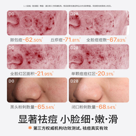 海龟爸爸双萃控油祛痘精华霜 商品图2