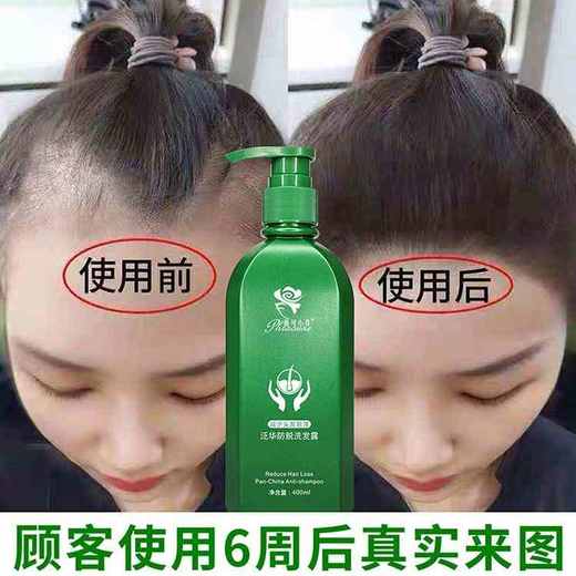 【控油防脱】泛华防脱洗发露两瓶装 052402 商品图1