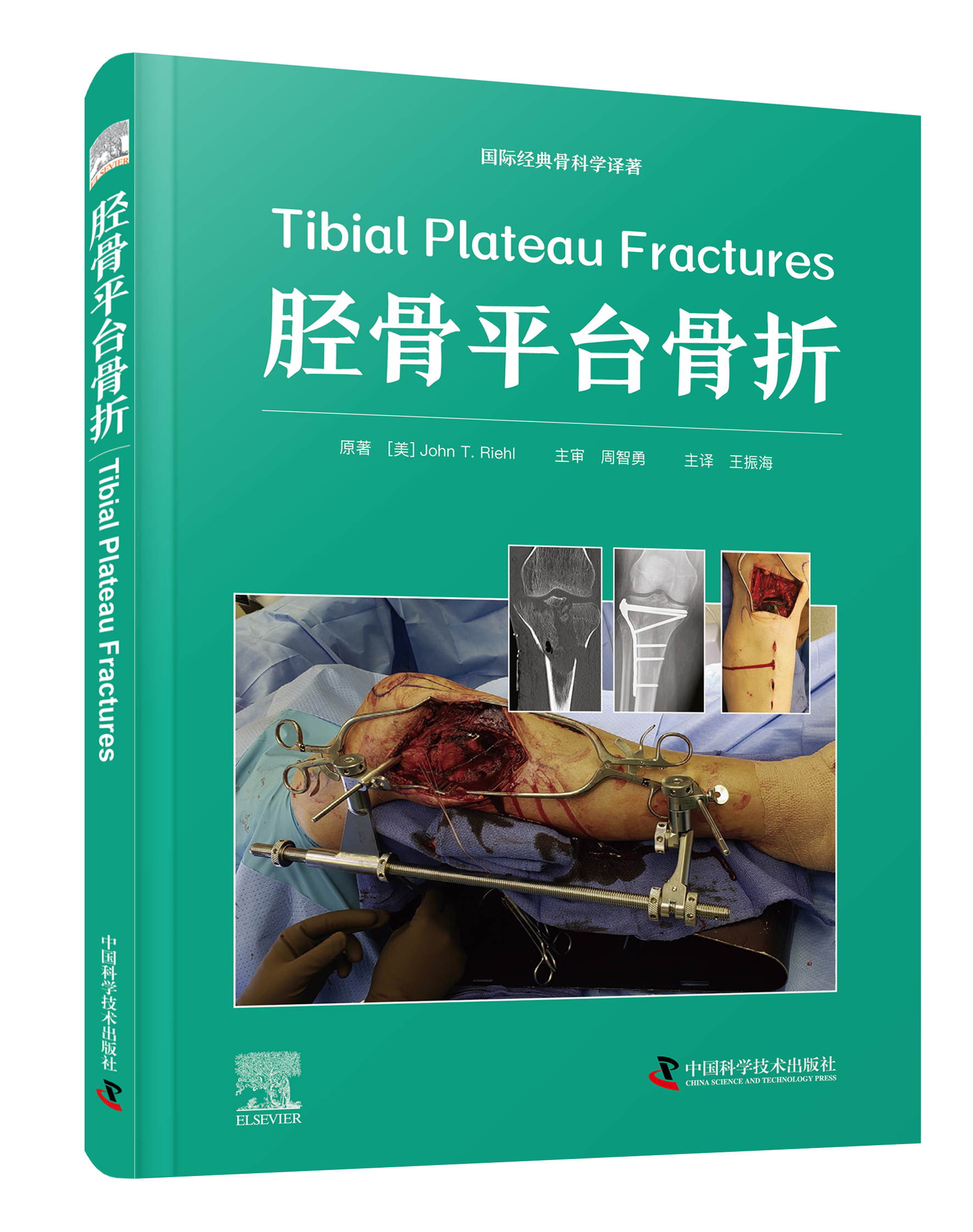 胫骨平台骨折 主译 王振海  辽科出版