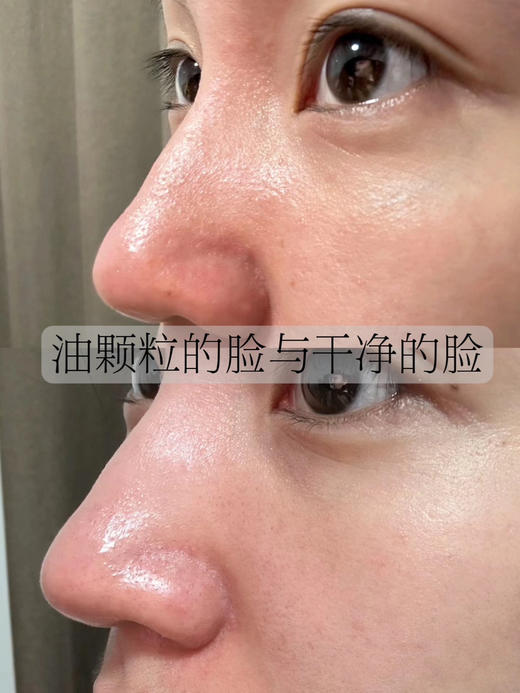 赠品翻倍升级！超好用！去黑头太绝了！ilso导出液黑头水150ml 商品图11