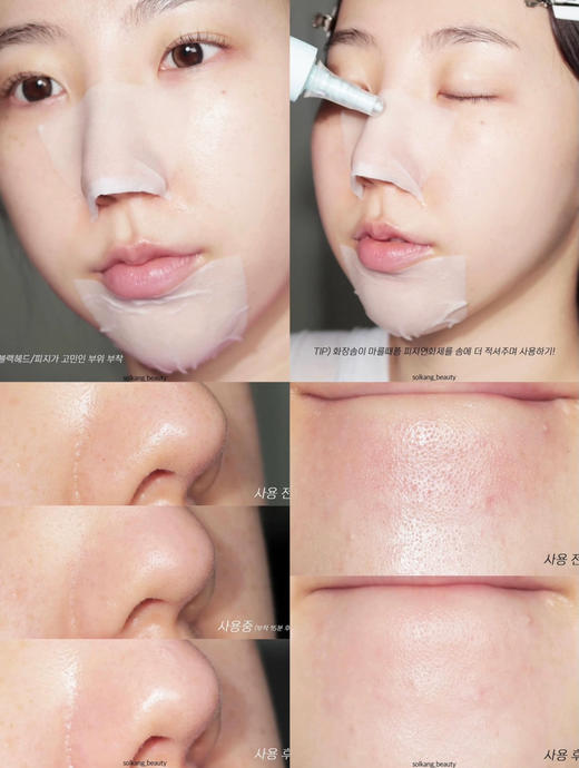 赠品翻倍升级！超好用！去黑头太绝了！ilso导出液黑头水150ml 商品图12