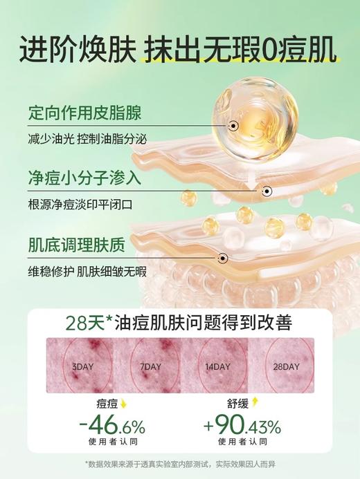 【老客专属福利】精研净油细肤精华水120ml+精研净油细肤精华乳100ml（送泛醇积雪草舒缓修护面膜3片）#层孔菌水乳套装控油祛痘补水保湿混油皮美白护肤品正品旗舰店男女 商品图4