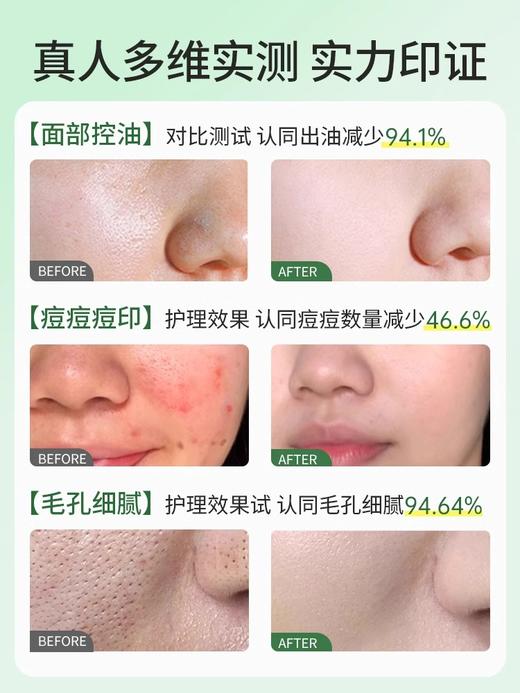 【老客专属福利】精研净油细肤精华水120ml+精研净油细肤精华乳100ml（送泛醇积雪草舒缓修护面膜3片）#层孔菌水乳套装控油祛痘补水保湿混油皮美白护肤品正品旗舰店男女 商品图2