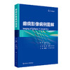 癫痫影像病例图解 田树平 卢强 范淼 癫痫PET/MR及MR诊断治疗疗效评估 临床病例影像诊断图谱影像表现9787117365116人民卫生出版社 商品缩略图1