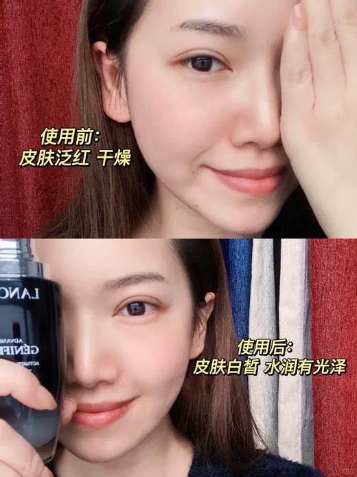 【8.4王炸割肉价】兰蔻肌底液花旦限量版115ml（效期至25.7） 商品图3