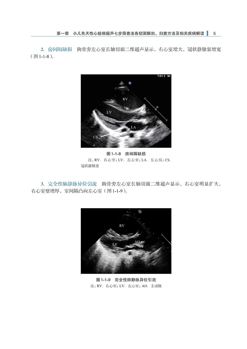 附录3-小儿先天性心脏病七步检查法-样张_5.jpeg
