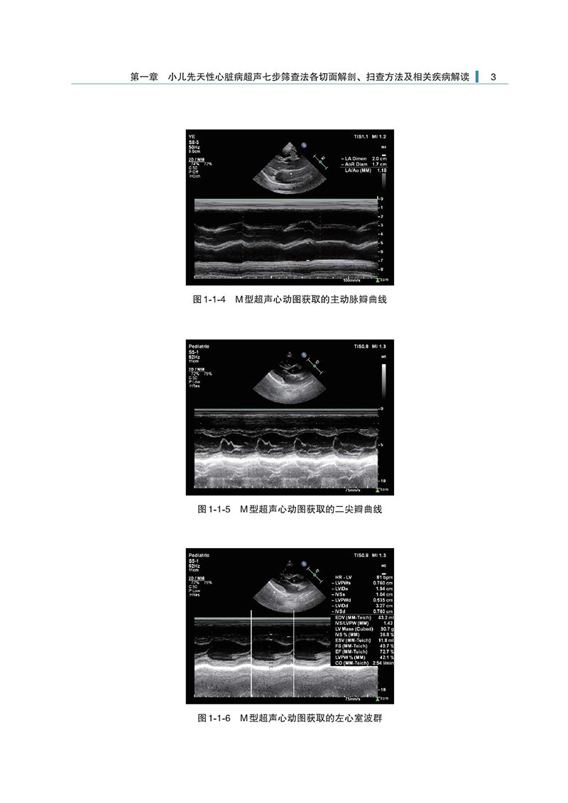 附录3-小儿先天性心脏病七步检查法-样张_3.jpeg