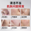 【梵西新品 119元任选3件】梵西控油净肤清洁面膜油皮深层清洁毛孔去黑头闭口粉刺补水收缩 28mlx5片 商品缩略图1