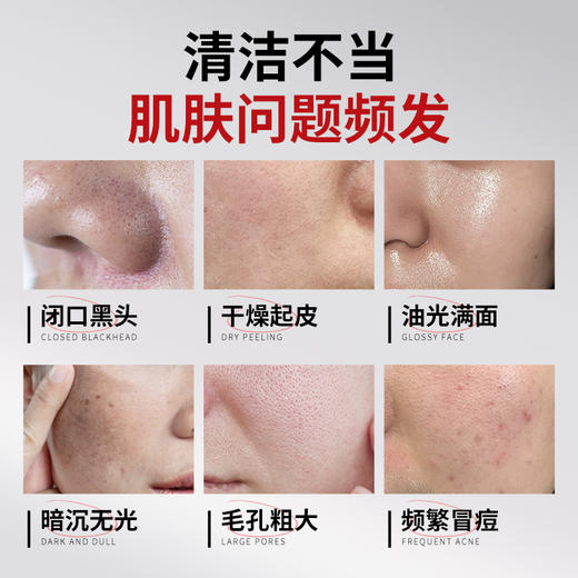 【梵西新品 119元任选3件】梵西控油净肤清洁面膜油皮深层清洁毛孔去黑头闭口粉刺补水收缩 28mlx5片 商品图1