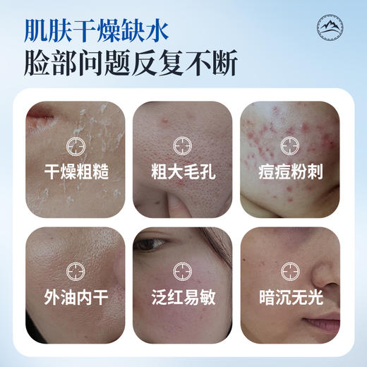 【梵西新品 119元任选3件】梵西冰川保湿舒缓喷雾舒缓保湿收缩毛孔爽肤水化妆水定妆喷雾正品  300ml/瓶 商品图1