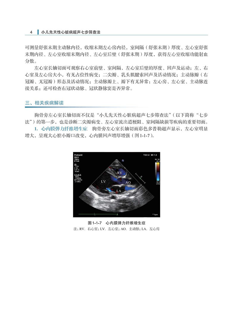 附录3-小儿先天性心脏病七步检查法-样张_4.jpeg