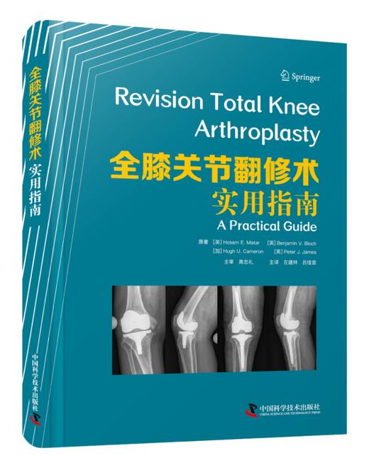 全膝关节翻修术：实用指南 商品图0