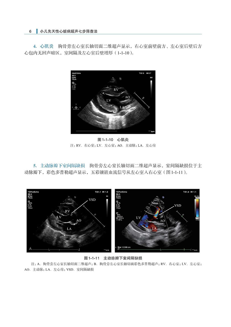 附录3-小儿先天性心脏病七步检查法-样张_6.jpeg